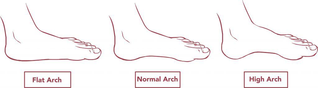 Types of Foot Arch