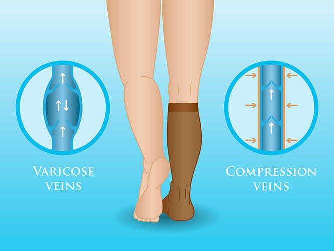 Best Compression Socks For Nurses