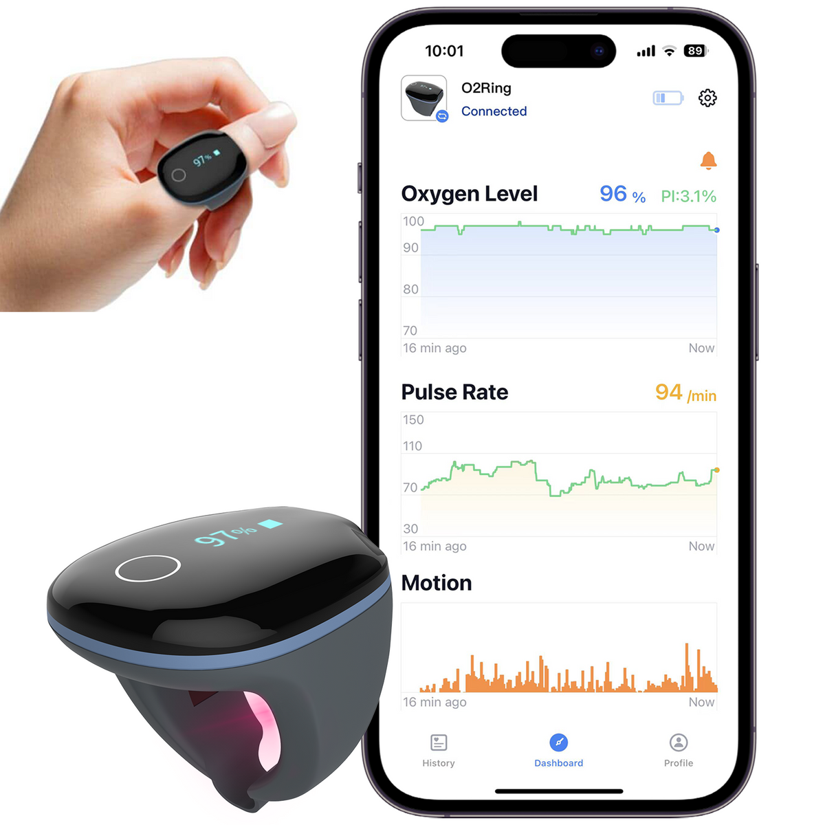 Wellue O2Ring continuous ring oxygen monitor